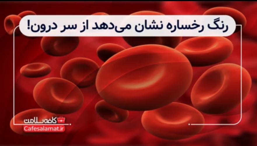 رنگ رخساره نشان می‌دهد از سر درون!