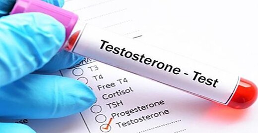 پایین بودن تستوسترون در مردان چه علائمی دارد؟