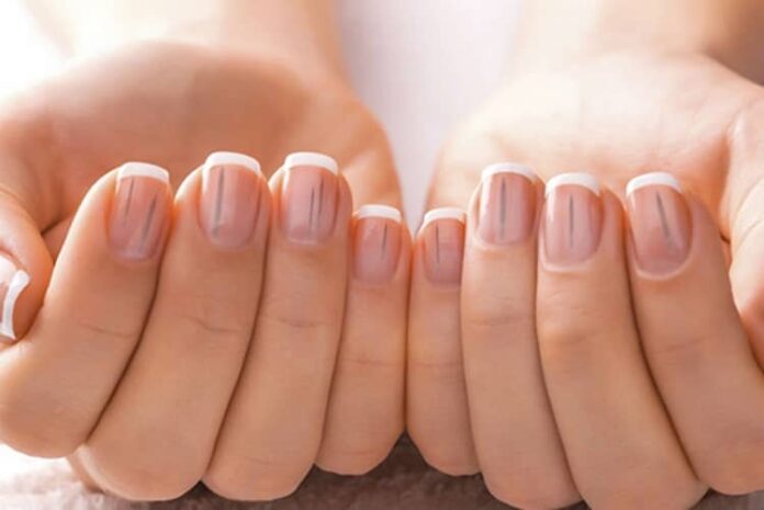 چرا باید نسبت به تغییر رنگ ناخن های خود حساس باشیم؟