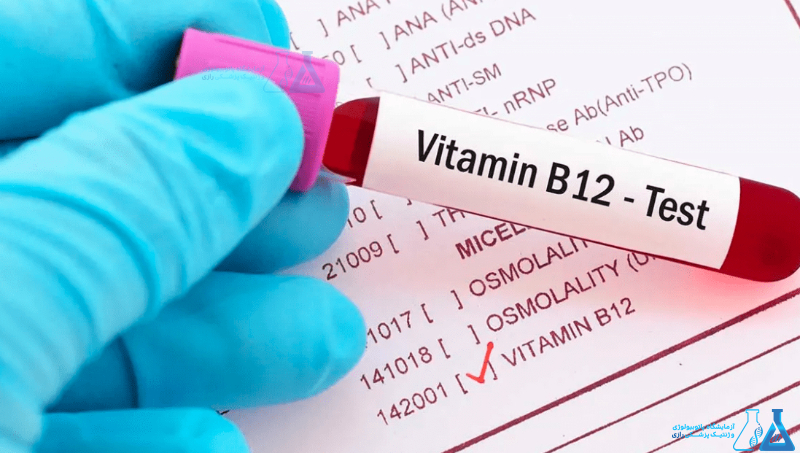تأثیر ویتامین B۱۲ بر عملکرد دستگاه عصبی 