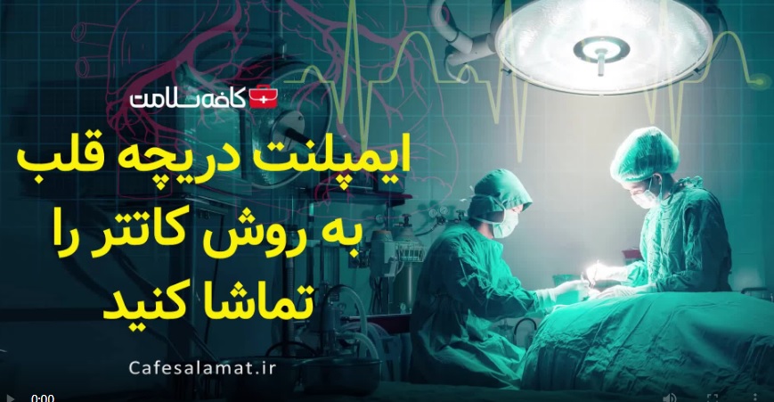 ایمپلنت دریچه قلب به روش کاتتر را تماشا کنید