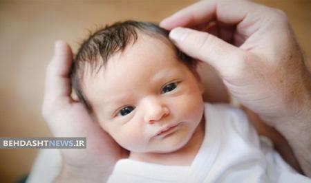 تشخیص طاسی در بزرگسالی با رمزگشایی ژنوم نوزاد 