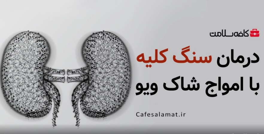 درمان سنگ کلیه با امواج شاک ویو
