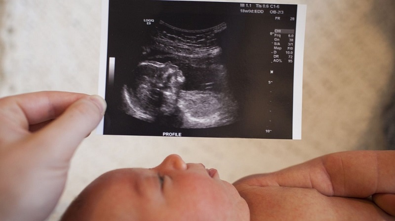 آیا سونوگرافی برای جنین بی‌خطر است؟