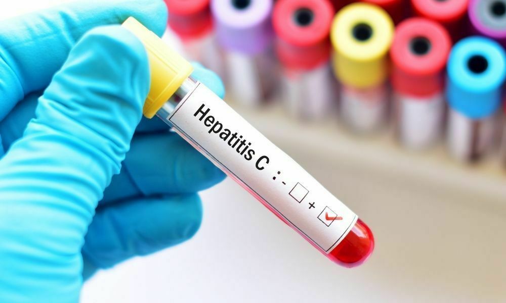این کشور بیشترین تعداد مبتلایان به هپاتیت C را در جهان دارد