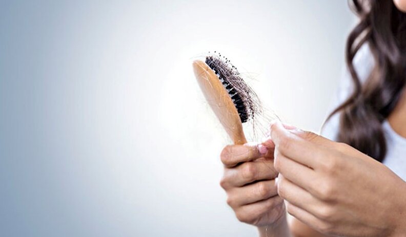چند راهکار طلایی برای کاهش ریزش مو