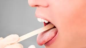  باکتری‌های دهانتان را به راحتی به اشتراک می گذارید؛ مراقب باشید!