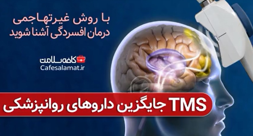 TMS جایگزین داروهای روانپزشکی