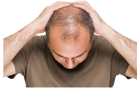 عواملی که باعث «ریزش مو» می‌شوند + اینفوگرافی