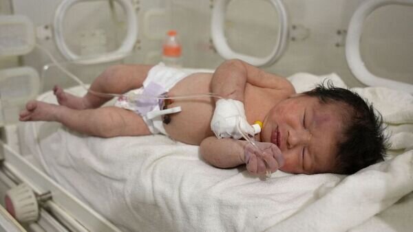 نوزاد سوری که از زیر آوار زنده بیرون آمد + عکس