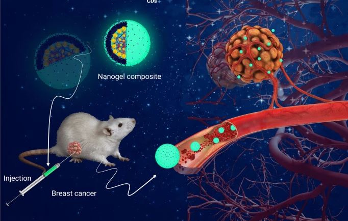 درمان موثر و تصویربرداری سرطان پستان با استفاده از نانوژل‌های کامپوزیتی فعال فلورسنت