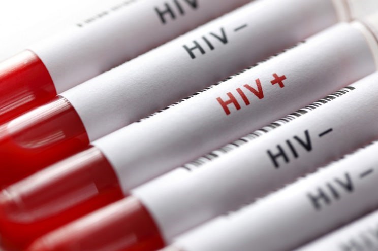 اینفوگرافیک؛ ویروس HIV از چه راههایی منتقل می شود؟