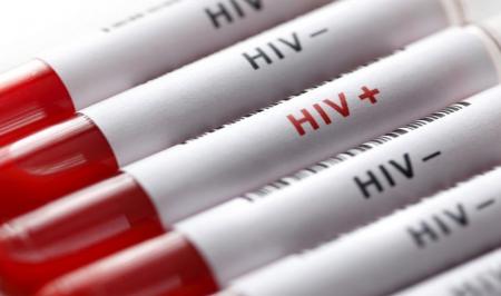 اینفوگرافیک؛ ویروس HIV از چه راههایی منتقل می شود؟
