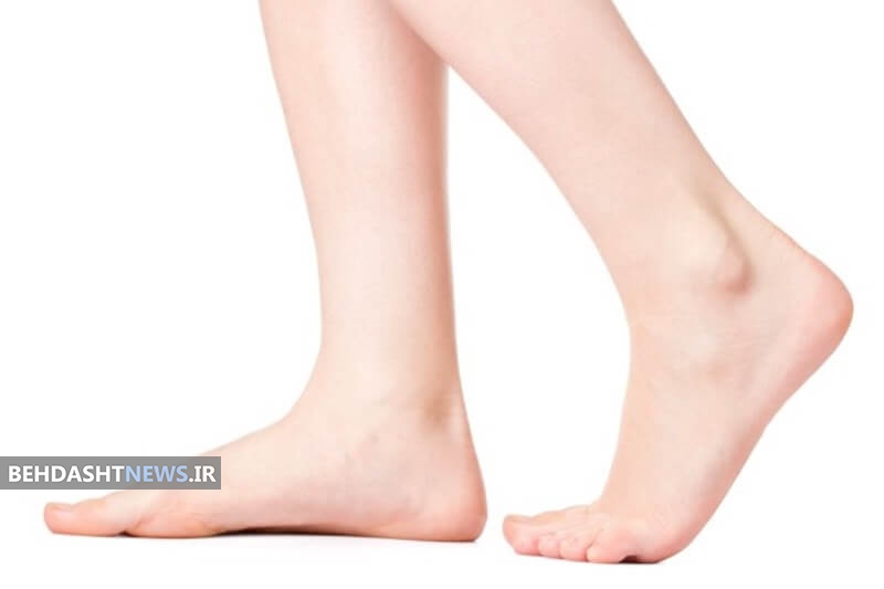  استفاده ازاستخوان اجساد؛درمانی نوین برای کف پای صاف