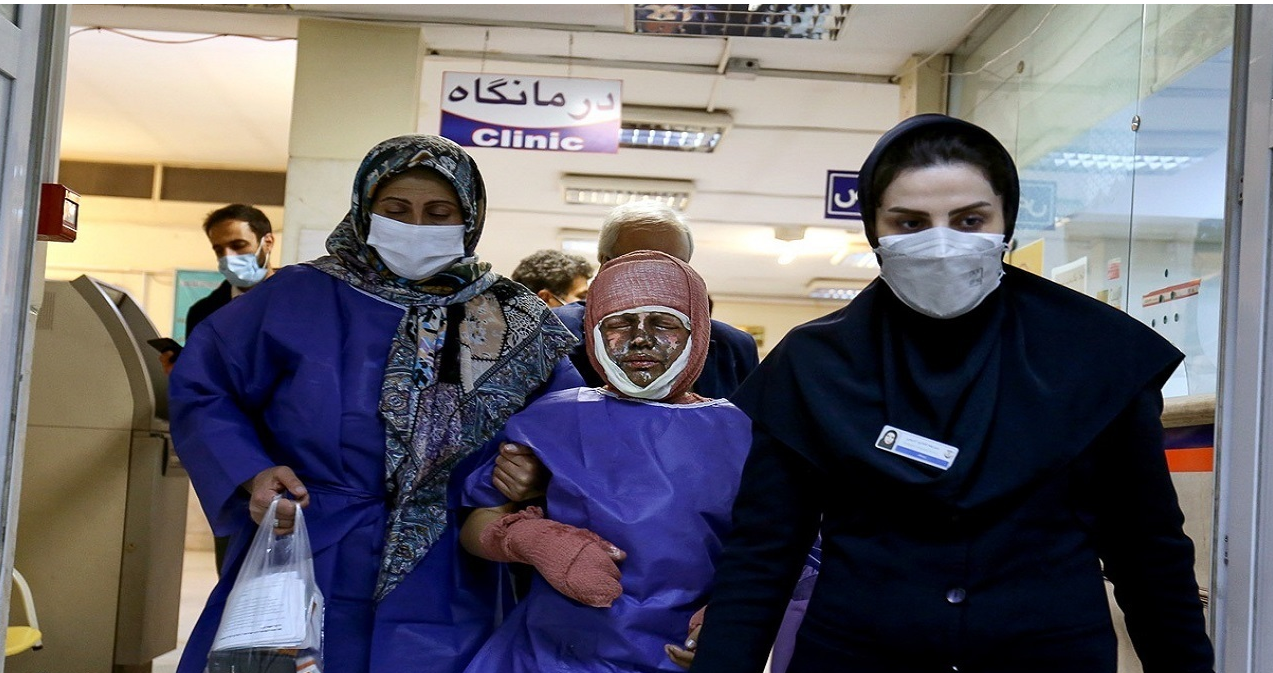 نحوه درمان خانگی افراد دچار سوختگی در چهارشنبه سوری