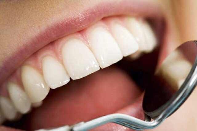 اهمیت به دندان‌های شیری را جدی بگیرید