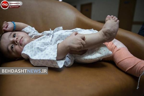  نوزاد عجیب الخلقه به دنیا آمد! / عکس های + 16