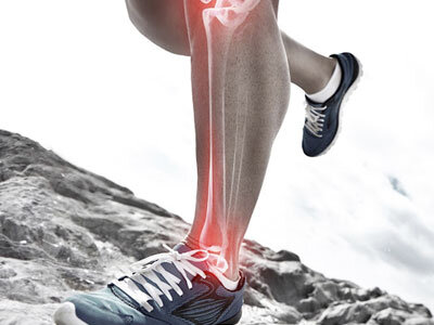 علت درد جلوی ساق پا برای چیست؟