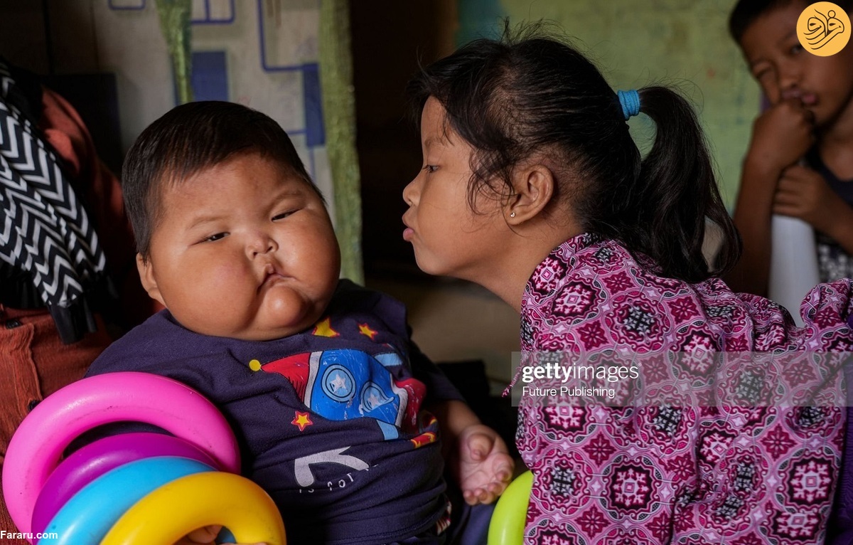 تصویری از نوزاد ۱۹ ماهه که ۲۷ کیلو وزن دارد + عکس