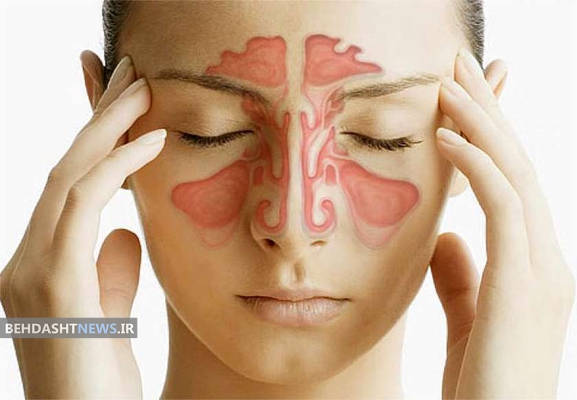 سینوزیت را چگونه درمان کنیم؟