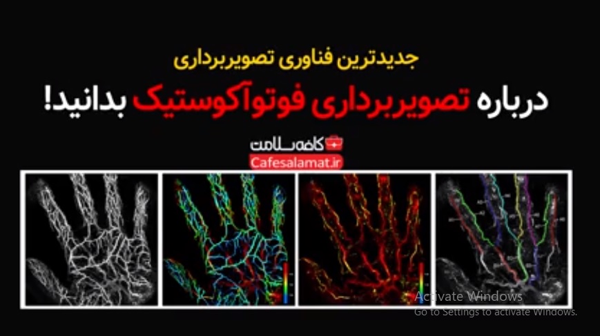 درباره تصویربرداری فوتوآکوستیک بدانید!