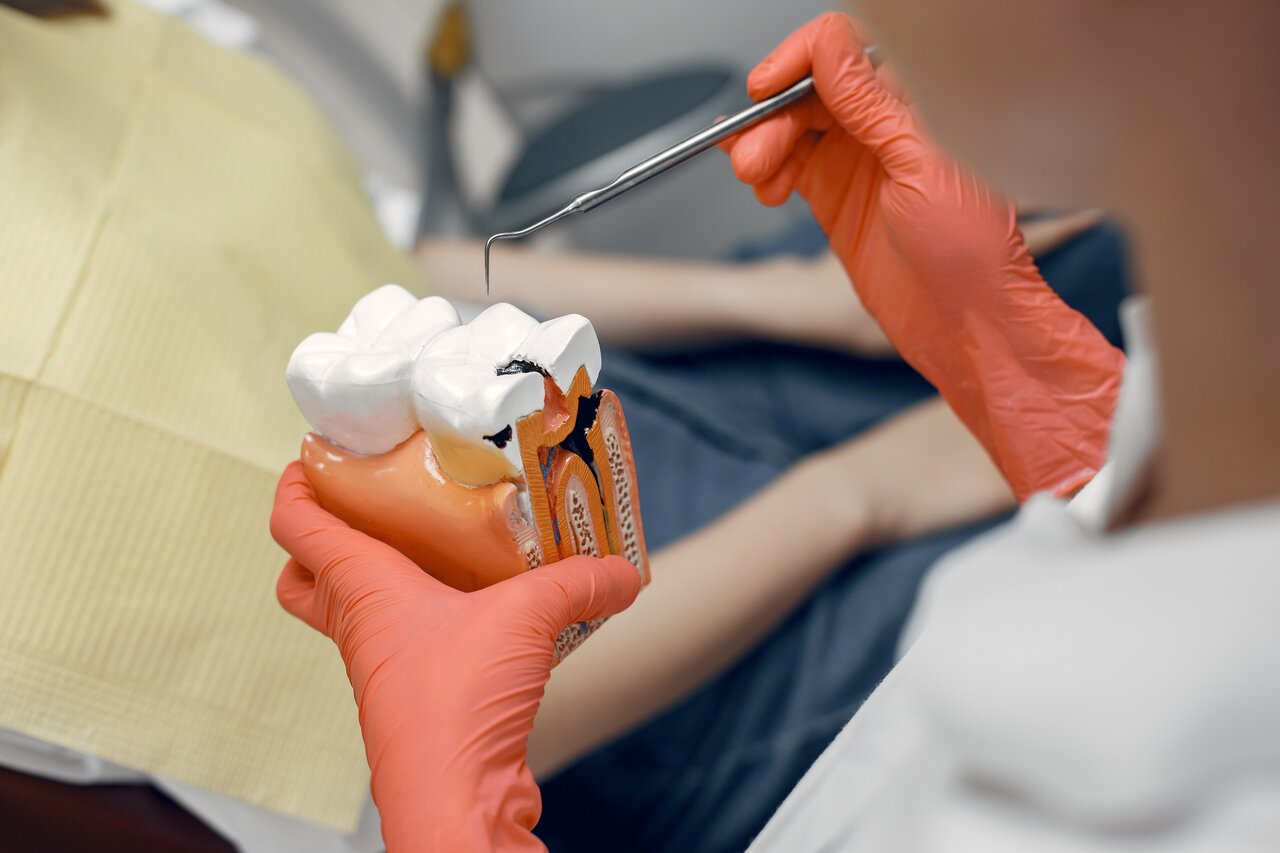 بلایی که ‍پوسیدگی دندان سر بقیه اعضای بدن می‌آورد