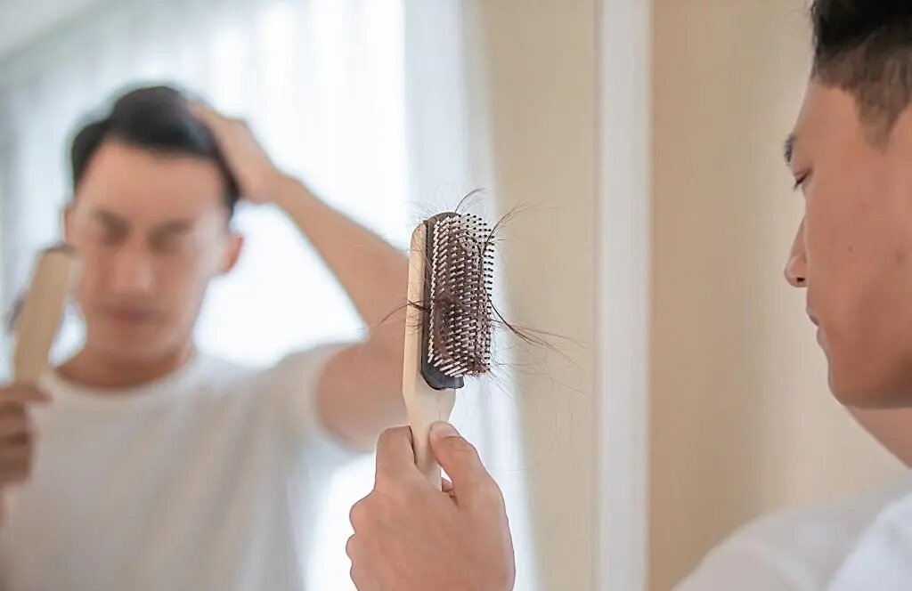چطور ریزش شدید موها را کنترل کنیم؟