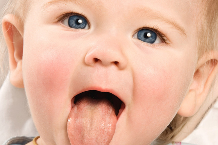 علت ایجاد سوزش زبان و دهان چیست ؟