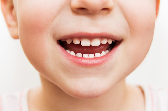 برای رشد و تکامل دندان در کودکان این مواد غذایی را بخورند و از این خوراکی ها پرهیز کنند