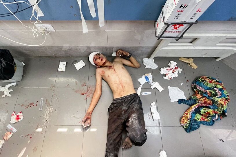 تصاویری جانکاه از زخمی های بمباران صهیونیست ها در غزه + عکس