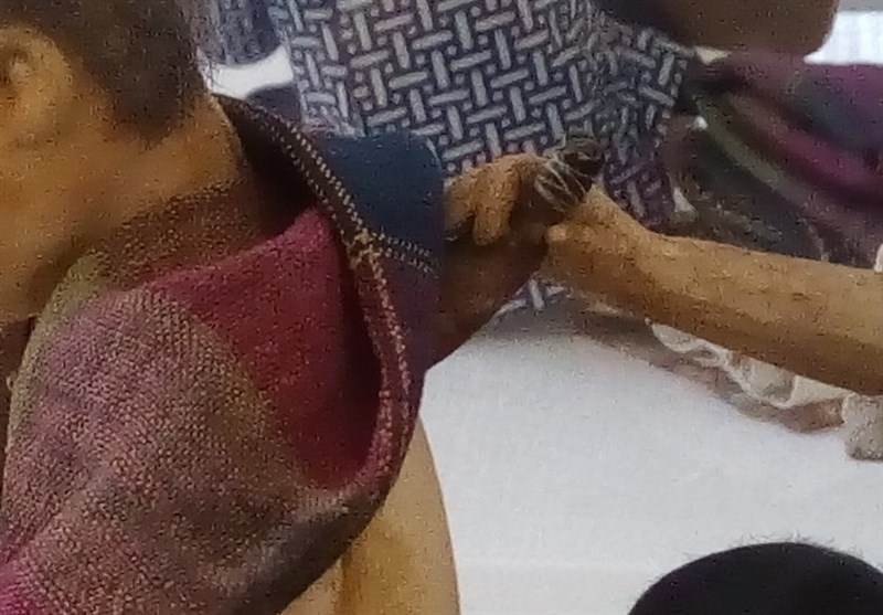 حجامت شاخ گاوی!+ تصویر 