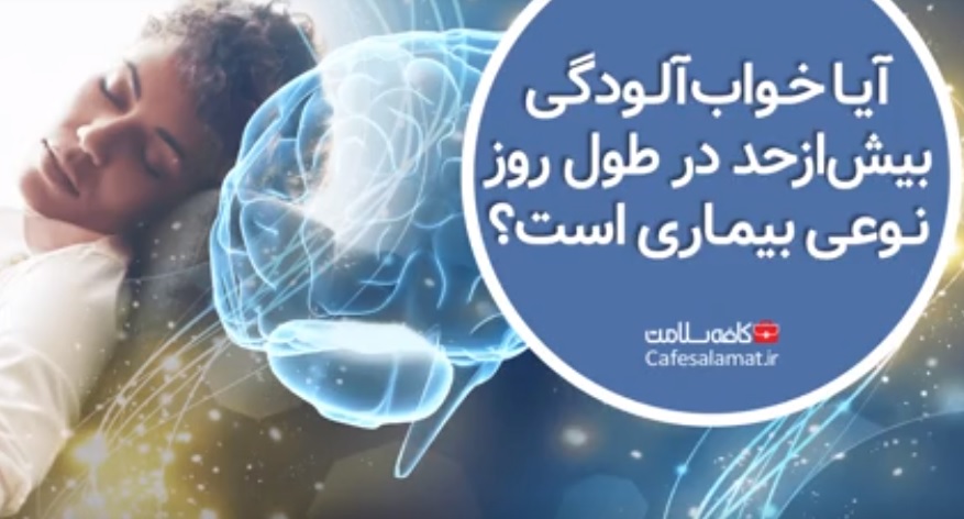 آیا خواب‌آلودگی بیش‌ازحد در طول روز نوعی بیماری است؟