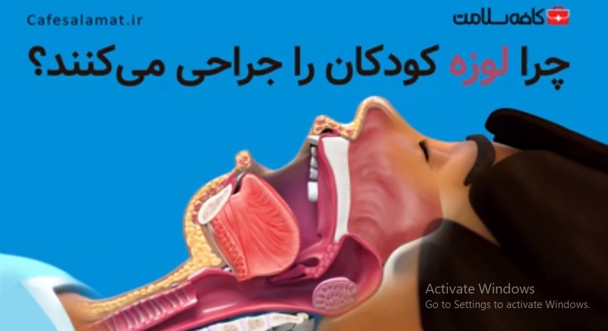 چرا لوزه کودکان را جراحی می‌کنند؟