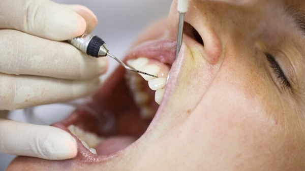 دیابتی ها مراقب این بیماری های دهان و دندان باشند