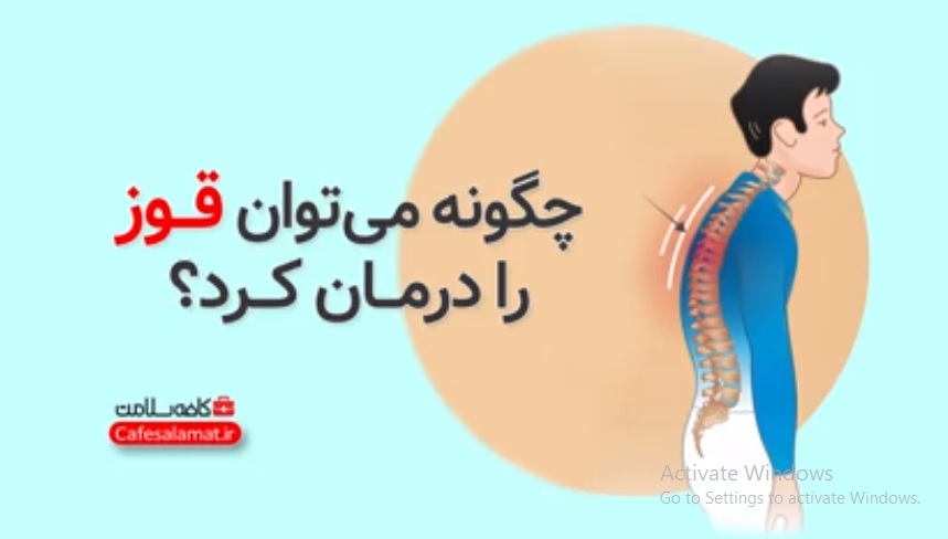 چگونه میتوان قوز را درمان کرد؟
