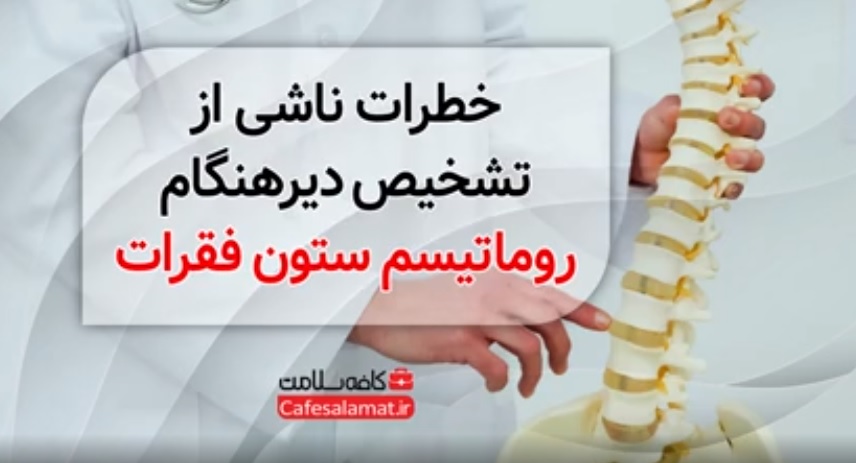 خطرات ناشی از تشخیص دیرهنگام روماتیسم ستون فقرات
