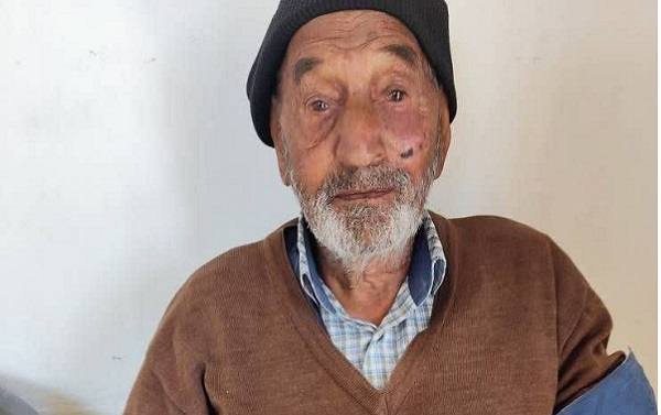 سالمند ۹۲ ساله ای که در پویش ملی سلامت شرکت کرده و بدون بیماری دیابت، فشارخون بالا و چربی خون تشخیص داده شد+ تصویر