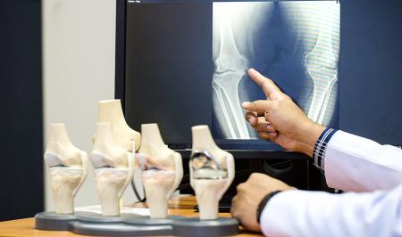 چه زمان مفصل زانو نیاز به جراحی دارد؟