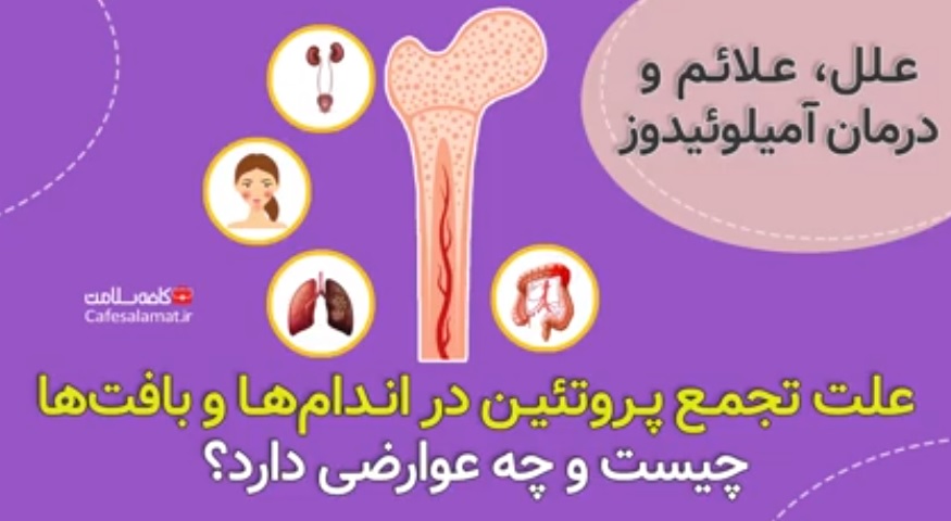 علت تجمع پروتئین در اندام‌ها و بافت‌ها چیست و چه عوارضی دارد؟