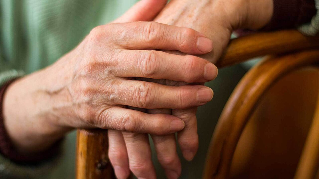 چه افرادی دچار آرتروز انگشت می‌شوند؟