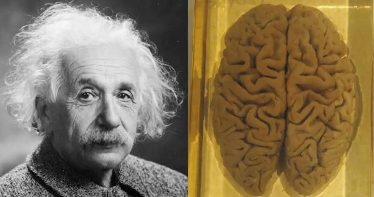  تصویری از مغز آلبرت اینشتین که در شیشه نگهداری می‌شود+عکس