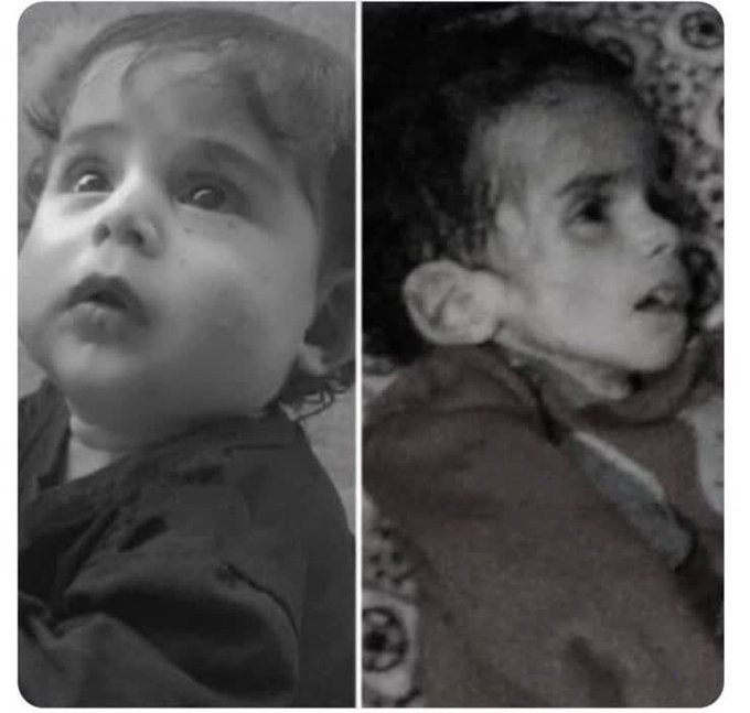 آخرین تصویر از دختر فلسطینی قبل و بعد از حمله رژیم صهیونیستی+عکس