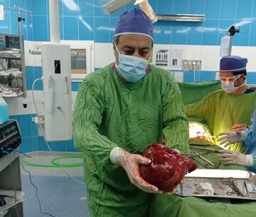 خارج کردن توده ۳ و نیم کیلویی از کلیه بیماری در تربت حیدریه+عکس