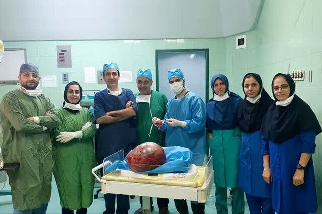 خارج کردن توده ۶ کیلویی از شکم زن آملی+عکس
