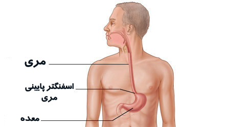 ۱۰ بیماری رایج مری