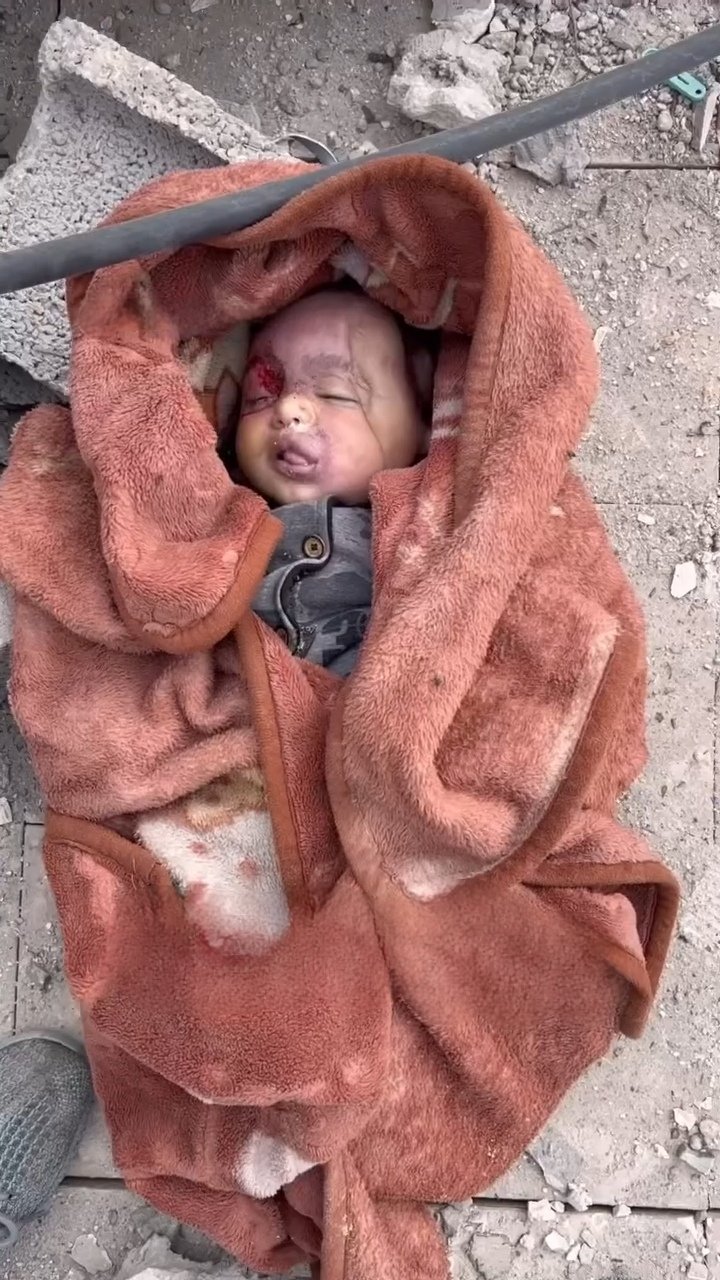 نوزادی که از میان خرابه‌های بیمارستان غزه بیرون کشیده شد+عکس