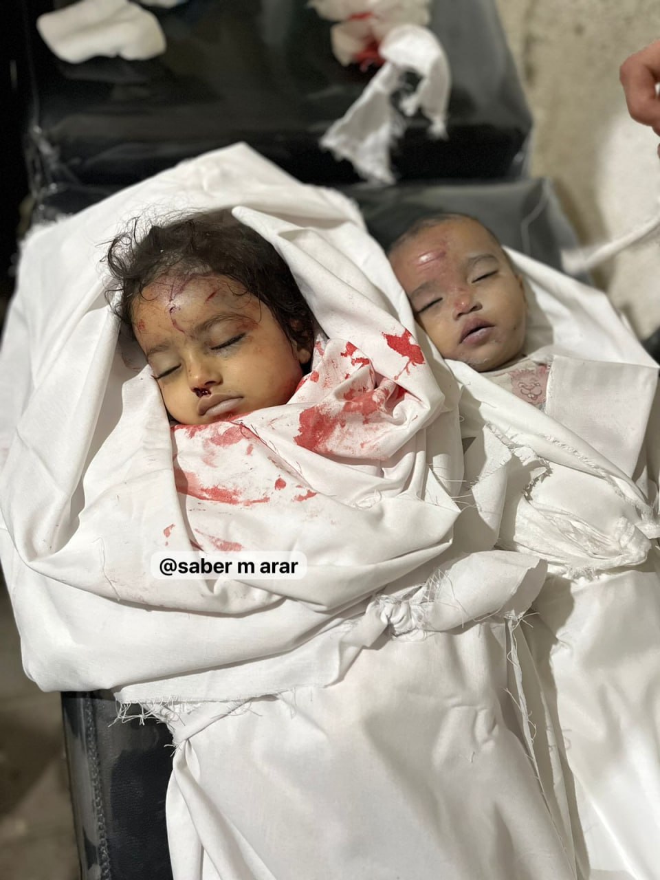 دو نوزادی که در رختخواب خود هدف بمباران صهیونیست‌ها قرار گرفتند+عکس