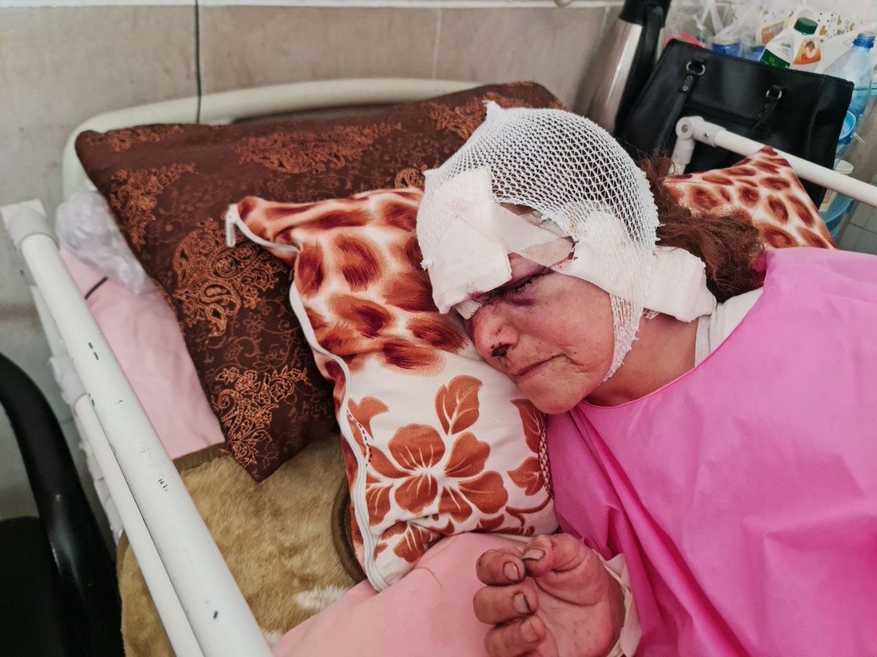 وضعیت خانم پیرانشهری پس از حمله خرس+عکس