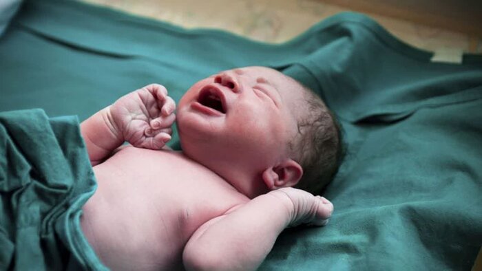 علل بروز یبوست در نوزادان را بشناسید