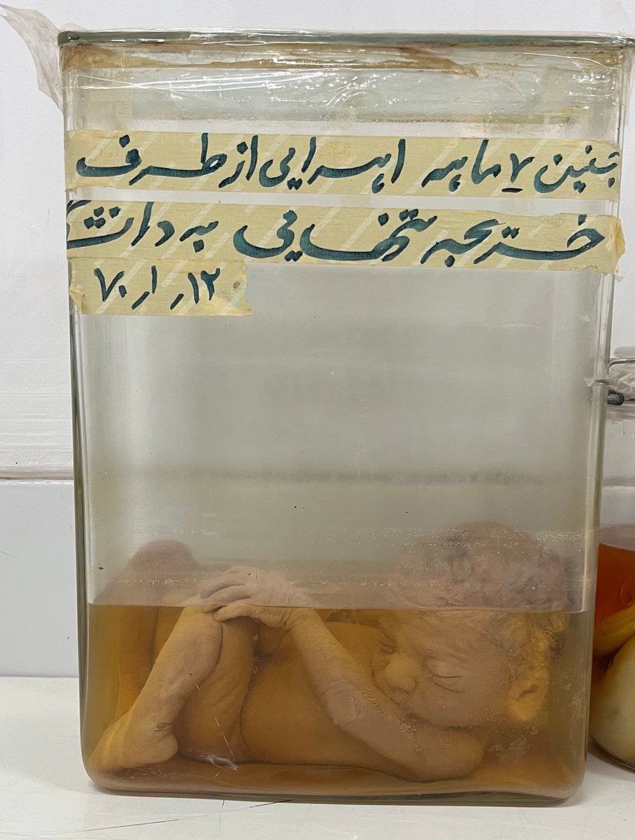 تصویر غم انگیز از یک جنین اهدایی در ایران+عکس